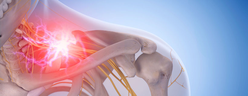 patient needing pinched nerve in need of Spinal Decompression Therapy in Colville