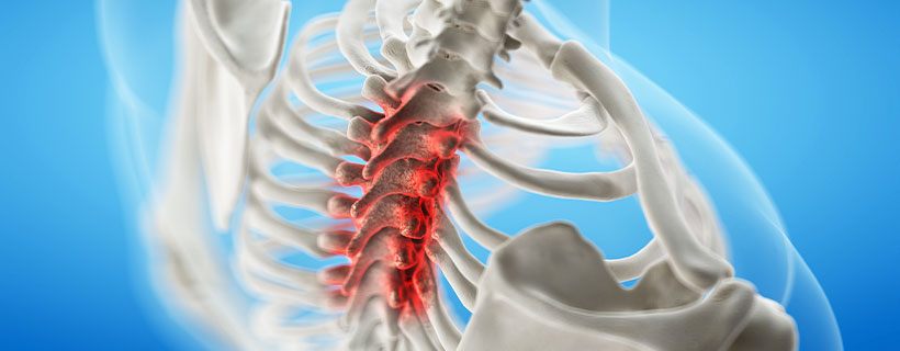 patient needing Spinal Stenosis in need of Spinal Decompression Therapy in Colville
