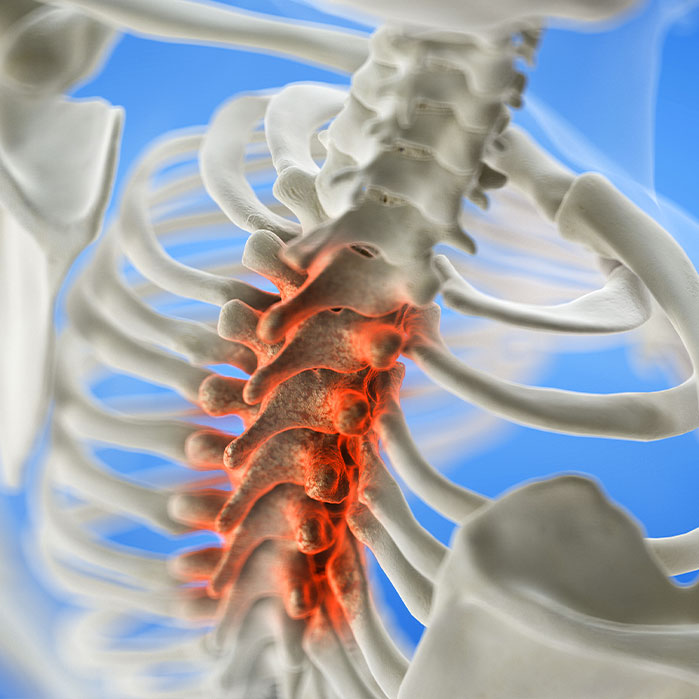 spinal Stenosis treatment in Colville
